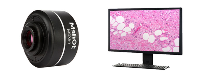 顯微鏡相機MV-6T 1600萬超高分辨率顯微數(shù)碼相機 64M內(nèi)存