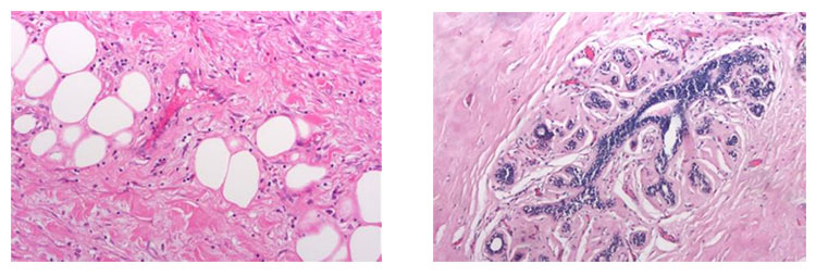 顯微鏡相機MV-6T 1600萬超高分辨率顯微數(shù)碼相機 64M內(nèi)存